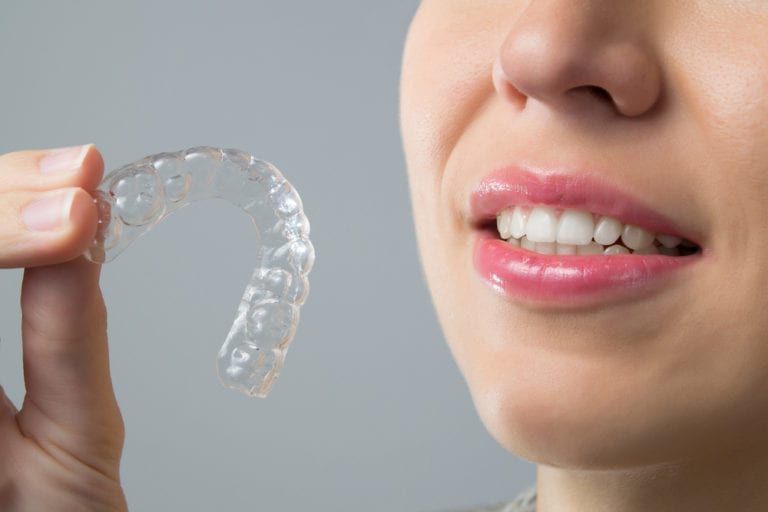 Invisalign-768x512-768x512.jpg.optimal